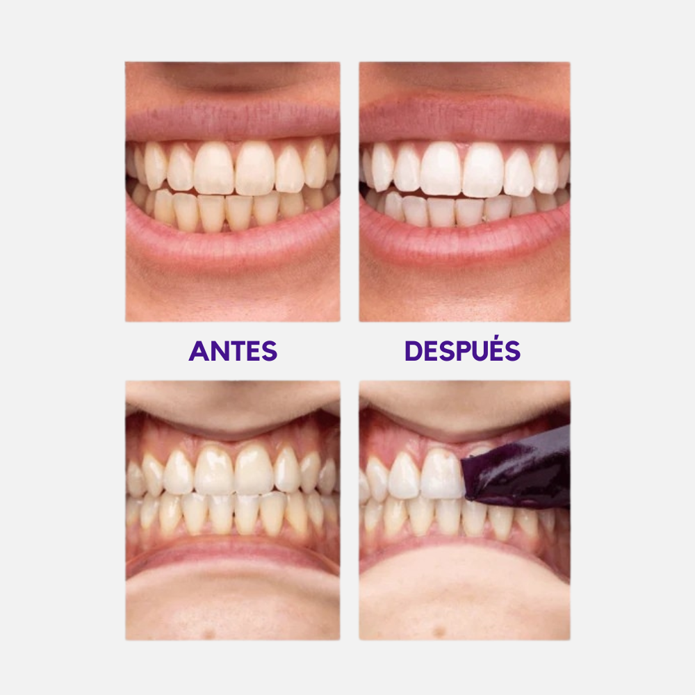 Tiras Blanqueadoras V34